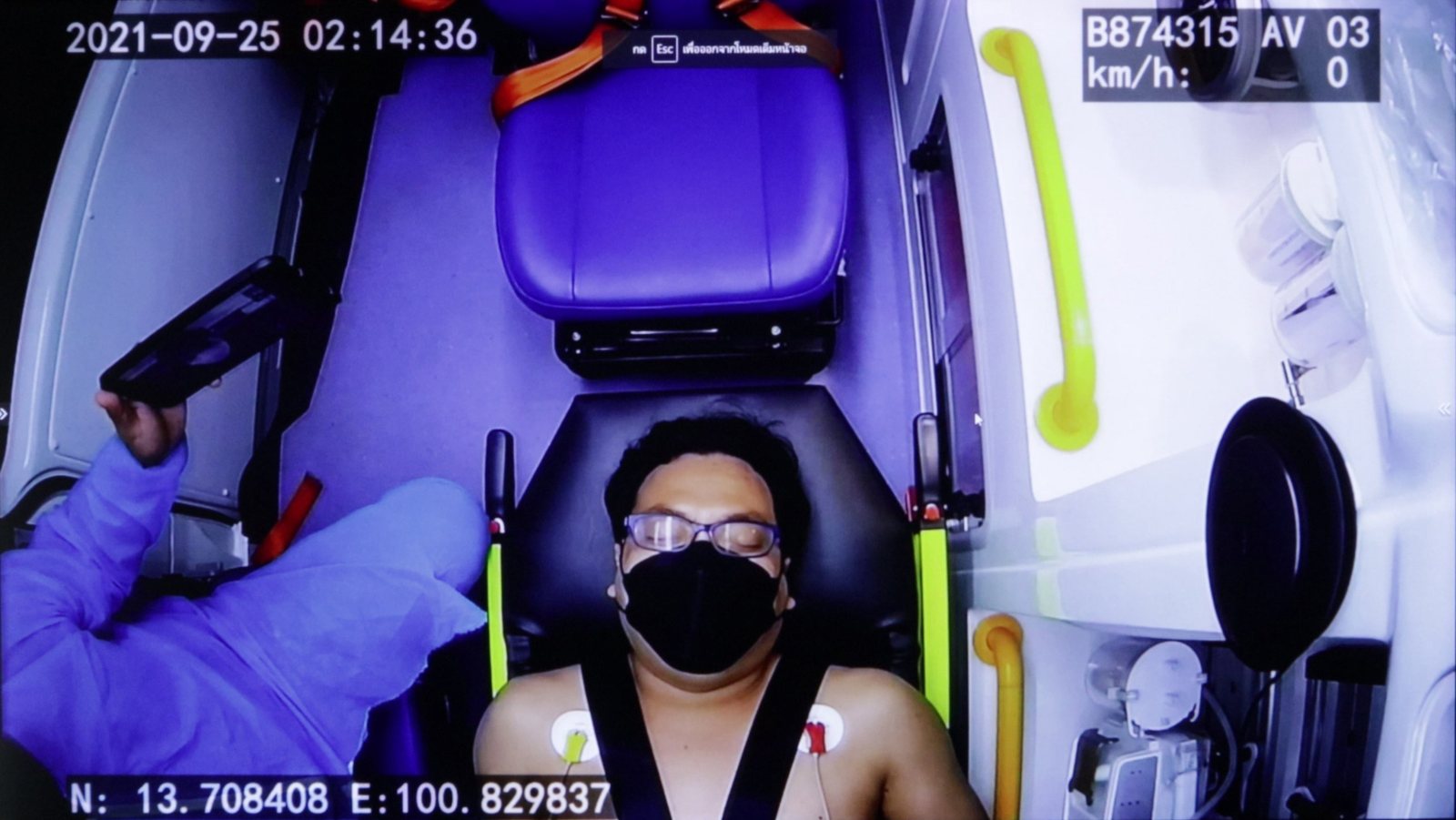 ภาพจากกล้องส่องอาการผู้ป่วย
